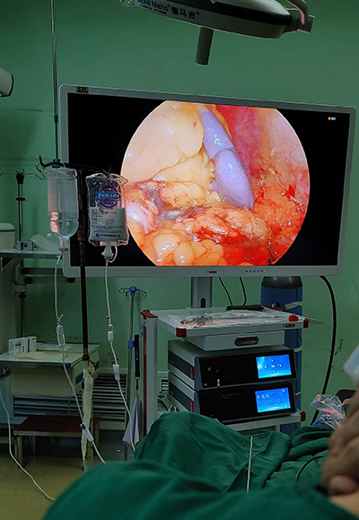 4K UHD Medical Endoscope Monitor 55”