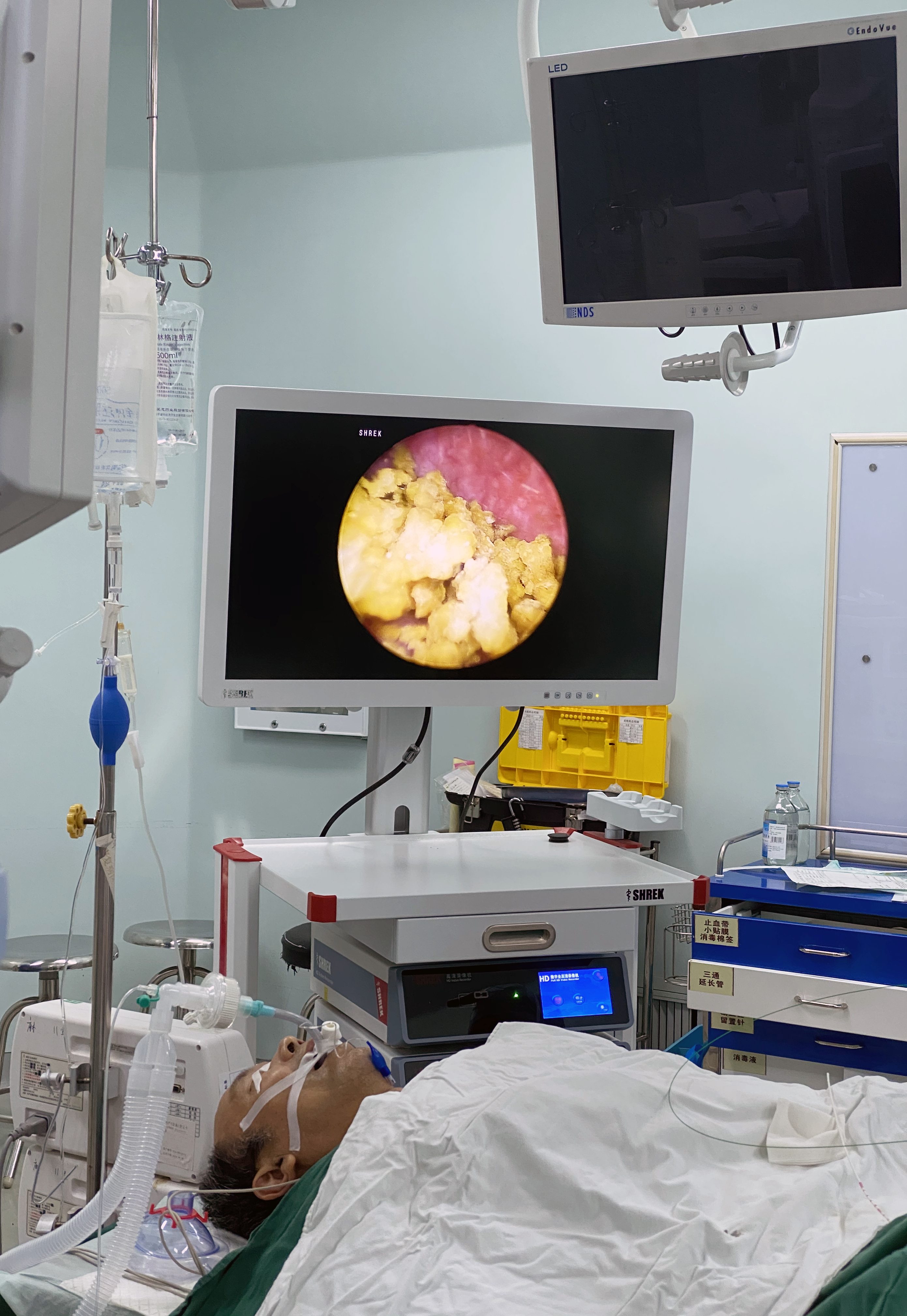 Medical FHD Endoscope Monitor 27＂